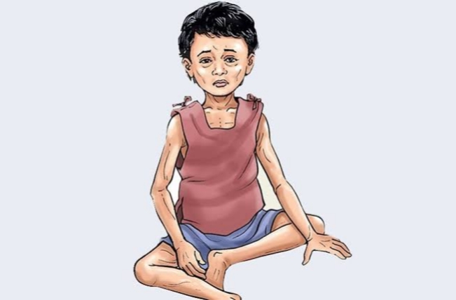 रायगड जिल्ह्यात कुपोषणाचे शुल्कसाट कायम